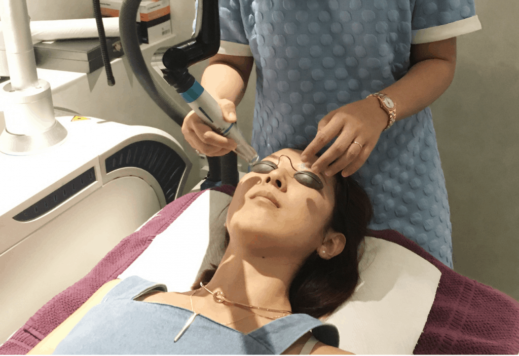 Singapore Blog Reviews on Facial Laser Treatment My Bliss Clinic