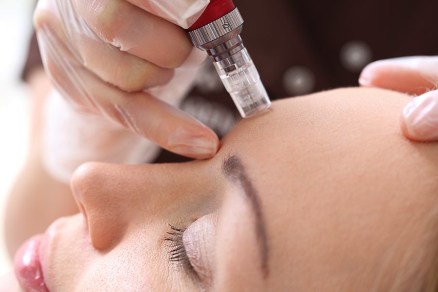 My Bliss Clinic Mesotherapy Blog Oct Featured Image