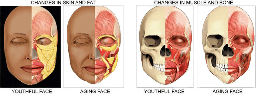 bone structure of face with age Bone Structure Of Face With Age