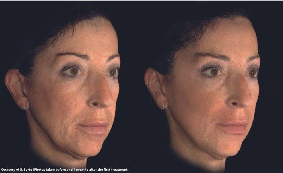 Image6 1 E1748402779129