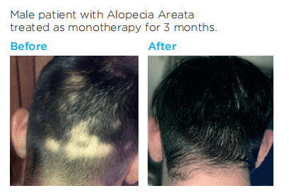 Nourkrin Beforeafter2