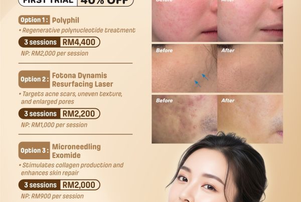 IG 02 July And August 2026 Promotion Social Media 1