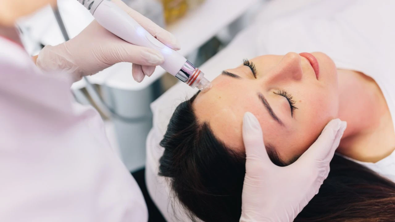 acne treatment on woman's forehead Acne Treatment On Womans Forehead